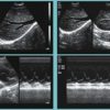 images echographiques du wed 3000