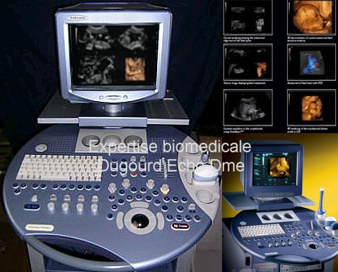 Échographe Voluson 730 pro imagerie volumique