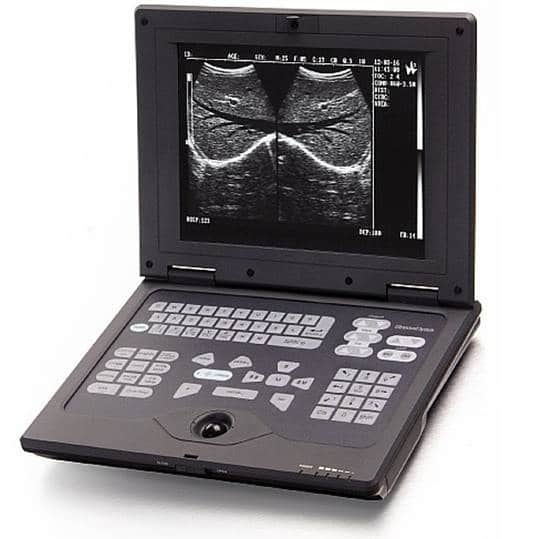 wed-2018 echographe portable wed-2018