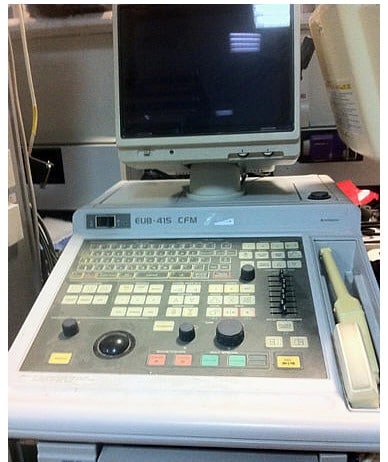 Echographe Hitachi Eub 415 CFM