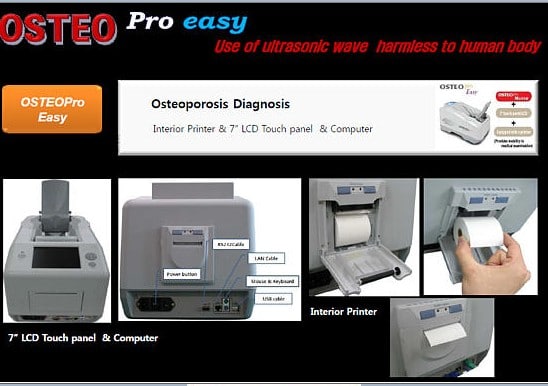 Osteodensitometre vente en ligne
