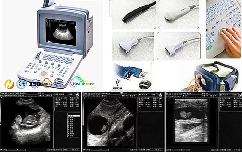 Echographe wed-9618-vet-nouveau-modele a ecran LCD