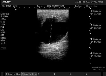 Echographe V9 image diagnostic