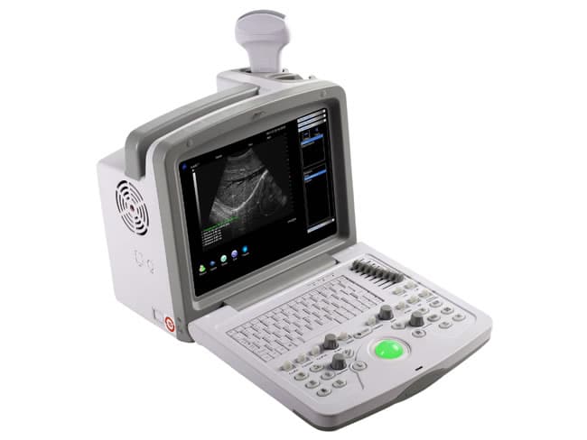 echographe wed 9618 gynecologie